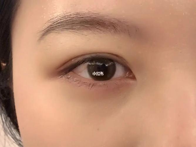 美瞳基弧是什么意思（美瞳基弧解析）